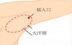 兰州北大皮肤科腋臭》》》进一步了解北